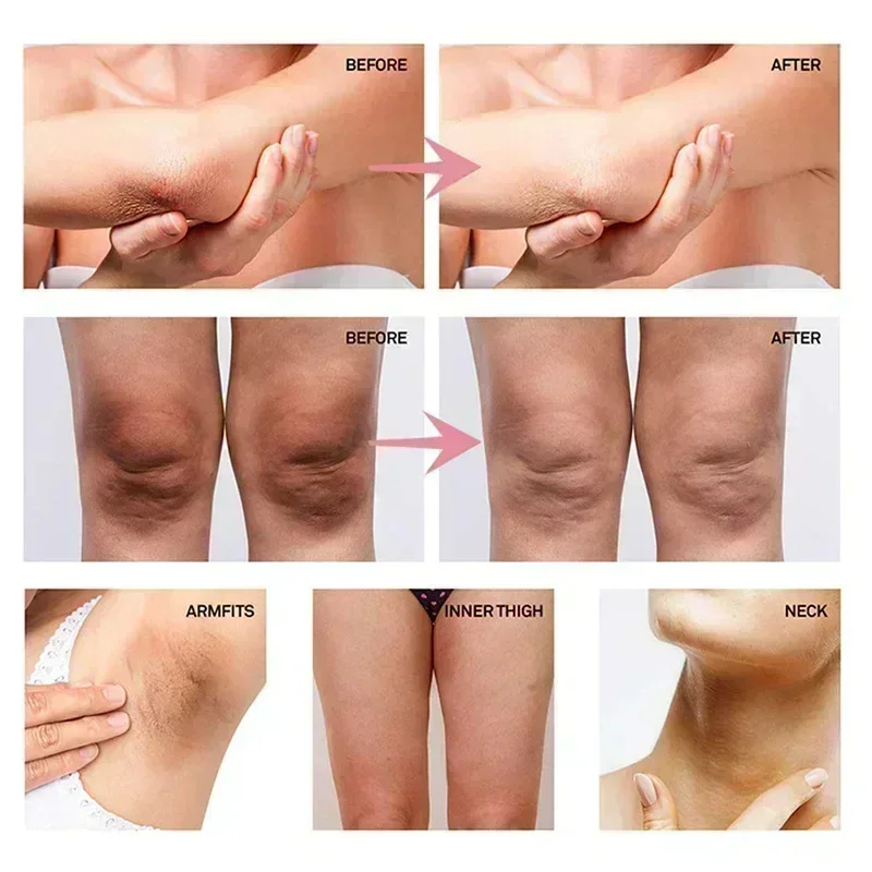 Collagen underarm whitening cr - Anti-Aging Face Cream incelemesi ve fiyatı