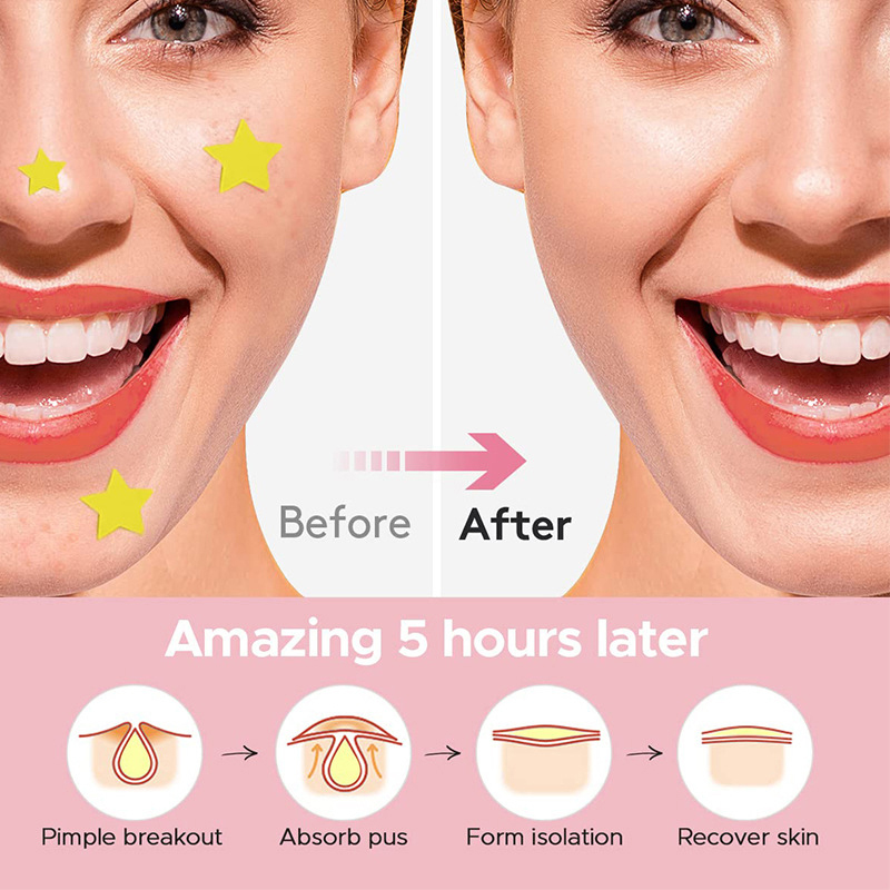 600 PCS/Set Star Pimple Patch  - Beauty Makeup Face incelemesi ve fiyatı