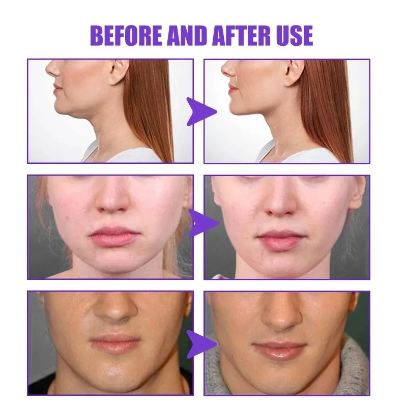 Face-lift Slimming Cream Slimm - Anti-Aging Face Cream incelemesi ve fiyatı