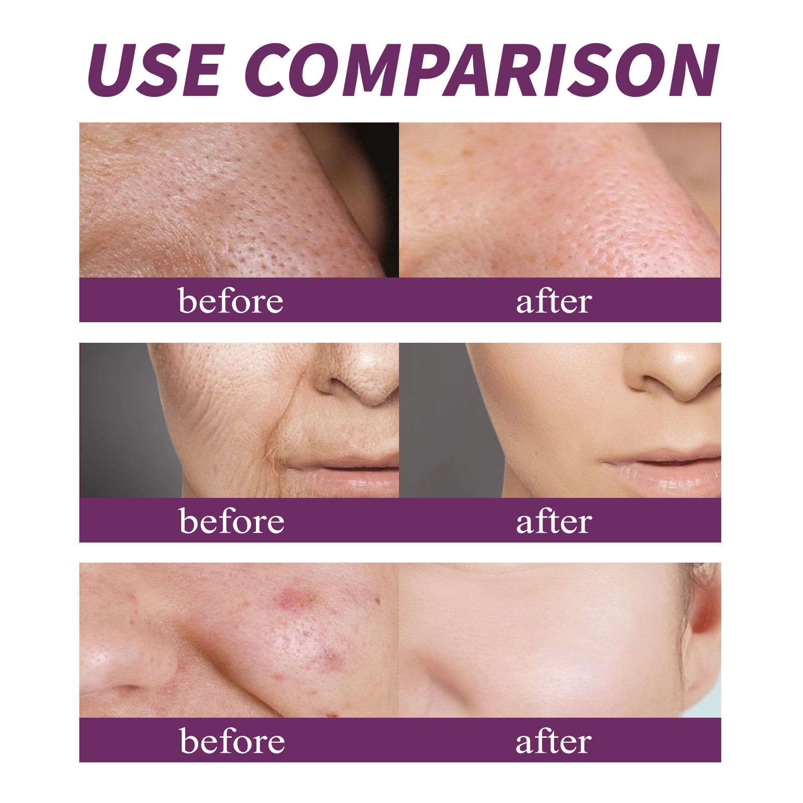 20% Niacinamide B3 Concentrate - Anti-Aging Face Cream incelemesi ve fiyatı